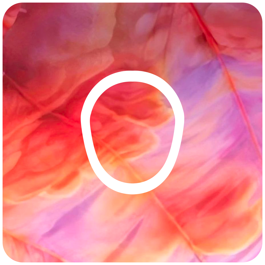 Taylor Swift Eras Tour-Inspired Diabetes Overpatch for Dexcom G7/G6, Libre, and Omnipod